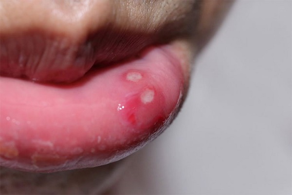 Uống điện giải có tác dụng gì?